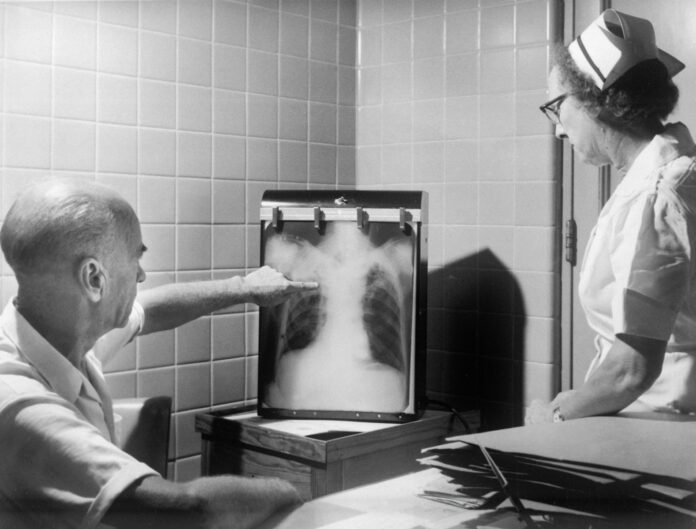 Photo by CDC a man and a woman looking at a chest x - ray